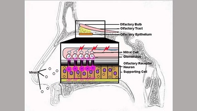a9a83e5d8cc74d9983960cf3b1ef090f.jpg