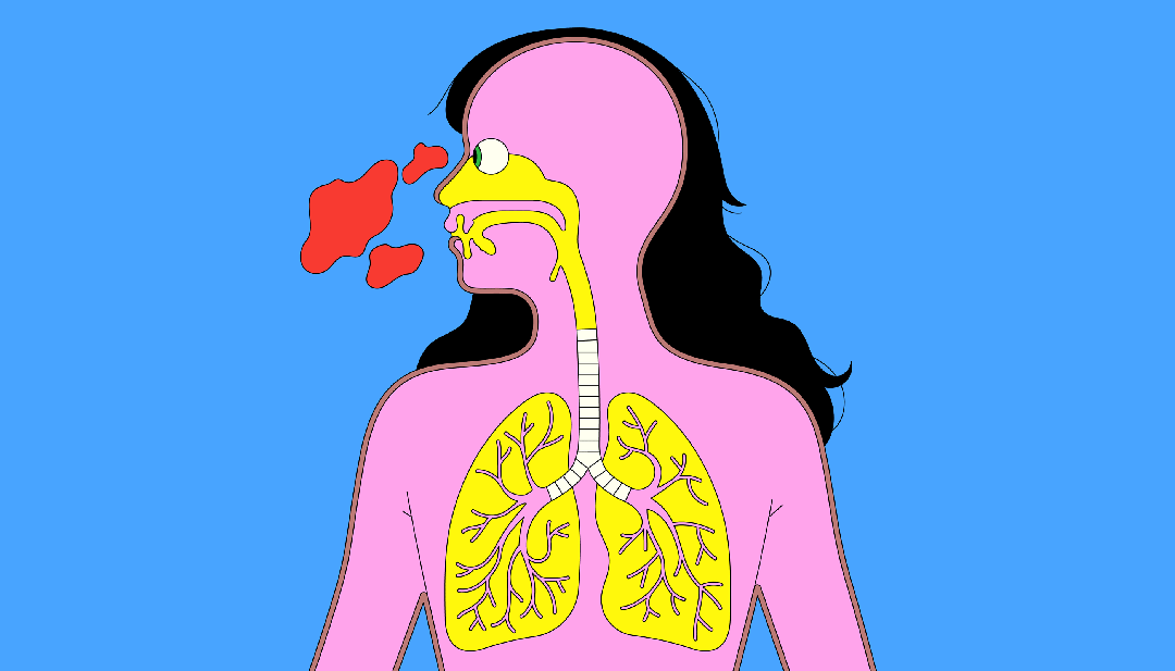 3.gif